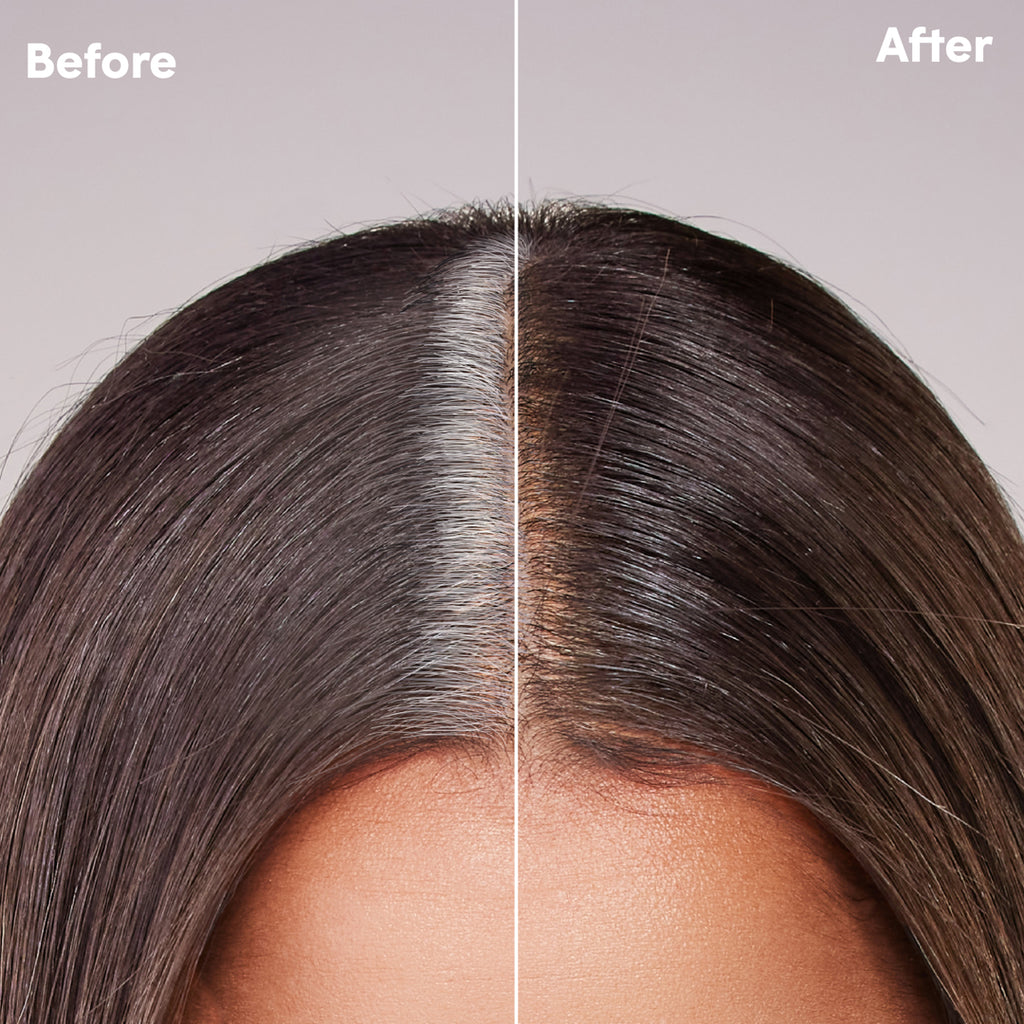 Root Touch-Up Kit for Resistant Grays - Medium Brown – dpHUE Pros